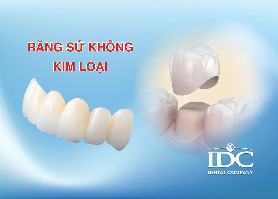 rang su khong kim loai