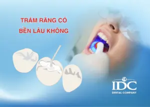 Vì sao bọc răng sứ bị đau nhức? 5 Nguyên nhân thường gặp