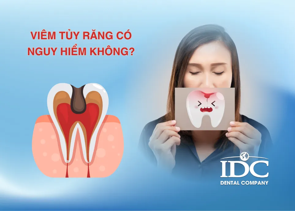 Bị viêm tủy răng có nguy hiểm không?