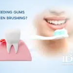 Bleeding Gums When Brushing?