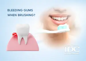 Same Day Dental Treatment in Da Nang: Fast Dental Care for Tourists and Expats