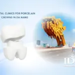 Dental Clinics for Porcelain Crowns in Da Nang