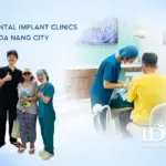 Top 5 Dental Implant Clinics in Da Nang City