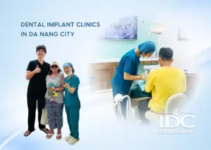 Tooth extraction cost in Da Nang City, Vietnam