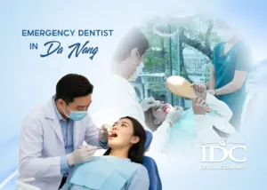 Dental Fillings