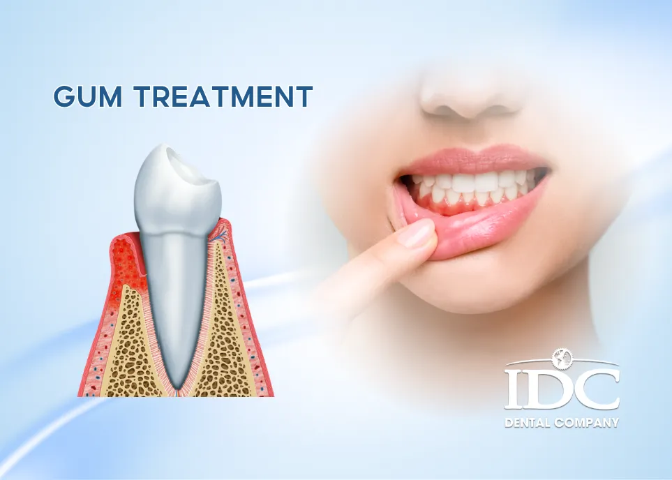 Gum Treatment in Da Nang