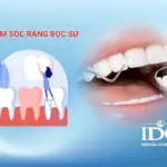 Cách chăm sóc răng bọc sứ đúng cách