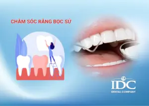 Chỉnh hàm hô không phẫu thuật ở Đà Nẵng: Giải pháp an toàn không đau