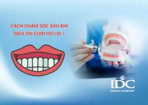 Cấy ghép implant là gì? Đối tượng nào phù hợp