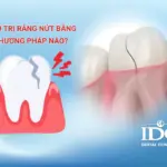 dieu tri nut rang bang phuong phap nao