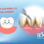 lay cao rang co dau khong