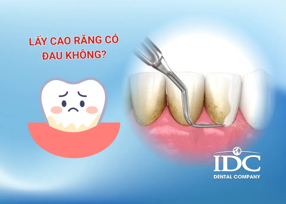 lay cao rang co dau khong