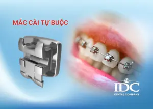 Chỉnh hàm hô không phẫu thuật ở Đà Nẵng: Giải pháp an toàn không đau