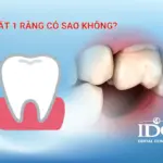 mat 1 rang co sao khong
