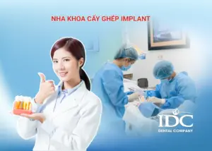 Trồng răng implant All-on-4 là gì? Giá bao nhiêu tại Đà Nẵng?