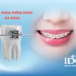 nha khoa nieng rang da nang