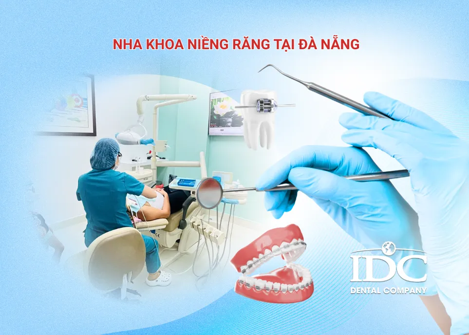 Nha khoa chỉnh nha tại Đà Nẵng