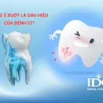 Răng ê buốt là dấu hiệu của bệnh gì?