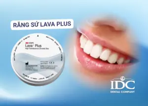 Niềng răng bị tiêu xương răng phải làm sao? (Nguyên nhân và giải pháp)