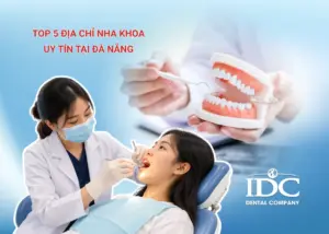 Trồng răng implant All-on-4 là gì? Giá bao nhiêu tại Đà Nẵng?