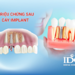 trieu chung sau khi cay implant