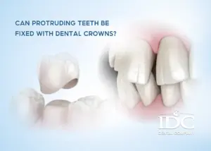 Gap Between Front Teeth: Causes and Effective Treatment Options