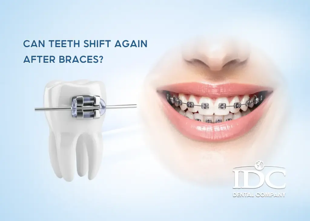 Can Teeth Shift Again After Braces? 