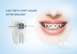 A Complete Guide to Dental Tourism in Da Nang
