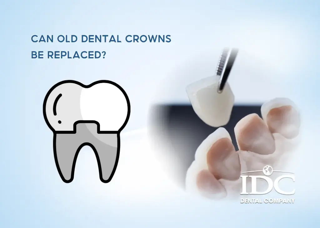 Can old dental crowns be replaced?