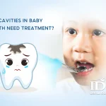 Do cavities in baby teeth need treatment?