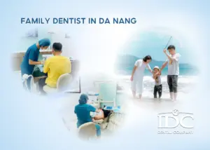 Top 5+ Best Teeth Whitening in Da Nang City for a Brighter Smile