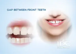 What to do when your child has a toothache? causes and safe treatment options