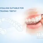Is Invisalign Suitable for Protruding Teeth