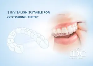 A Complete Guide to Dental Tourism in Da Nang