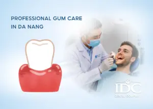 Dental Veneer