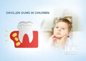 Swollen Gums in Children