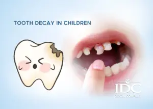 Teeth Whitening