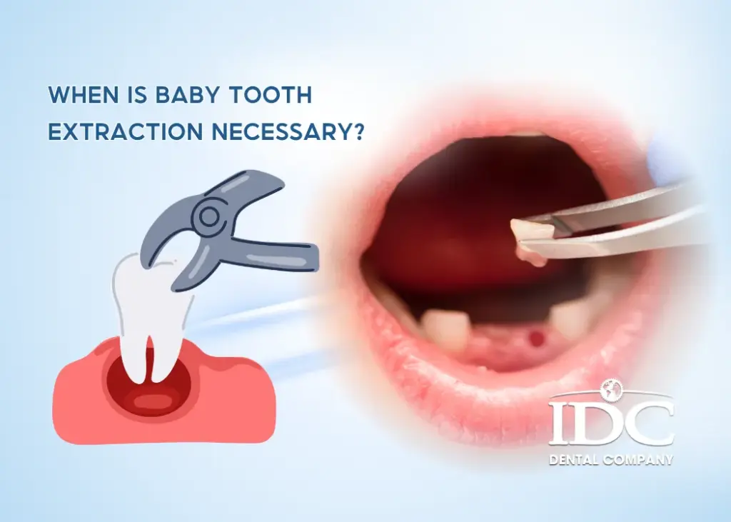 When is baby tooth extraction necessary?