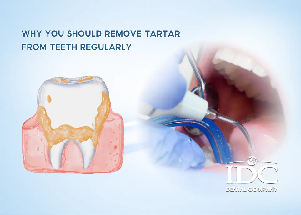 Why You Should Remove Tartar from Teeth Regularly