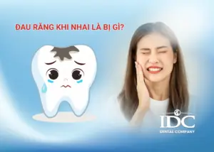 Men răng yếu phải làm sao? (Nguyên nhân và cách phục hồi)