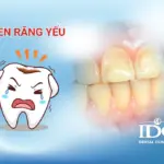 Men răng yếu phải làm sao?