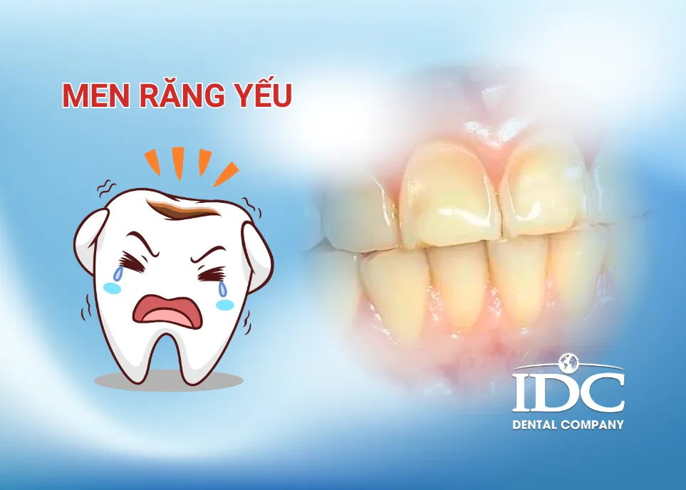 Men răng yếu phải làm sao?