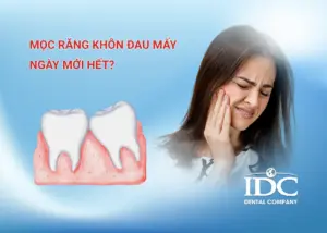 Sưng lợi có mủ có nguy hiểm không? Khi nào cần điều trị?