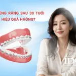 nieng rang sau 30 tuoi co hieu qua khong