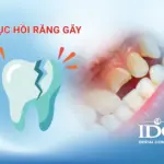 Dấu hiệu sâu răng là gì?