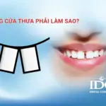 Răng cửa thưa phải làm sao?