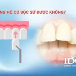 rang ho co boc su duoc khong
