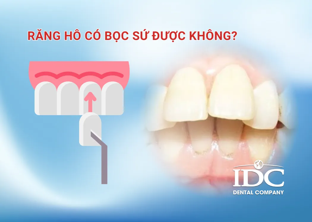 rang ho co boc su duoc khong