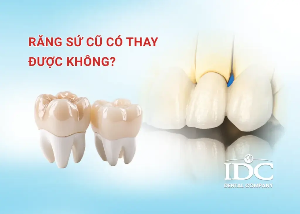 Răng sứ cũ có thay được không?