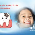 Răng sữa bị sâu có cần điều trị không?